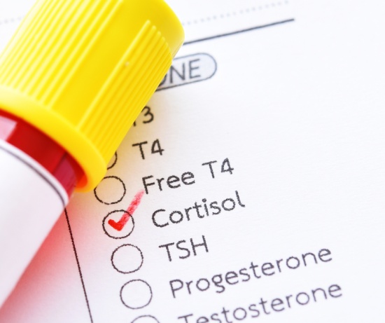 adrenal stress testing